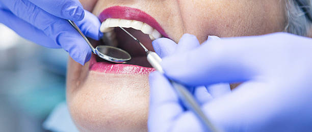 Best Emergency Treatment for Toothache in Blacksburg, VA